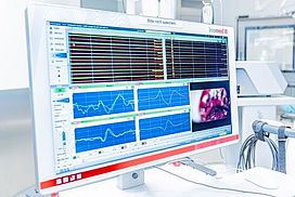 Das Bild zeigt einen Bildschirm, auf dem man ein Elektrophysiologisches Intraopertives Monitoring (IOM) erkennen kann.